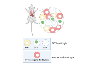 Spatial metabolomic and lipidomic analysis of liver diseases using MALDI mass spectrometry imaging